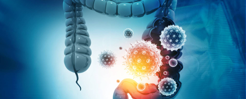 ColonAiQ – DNA-basierte Darmkrebs Früherkennung